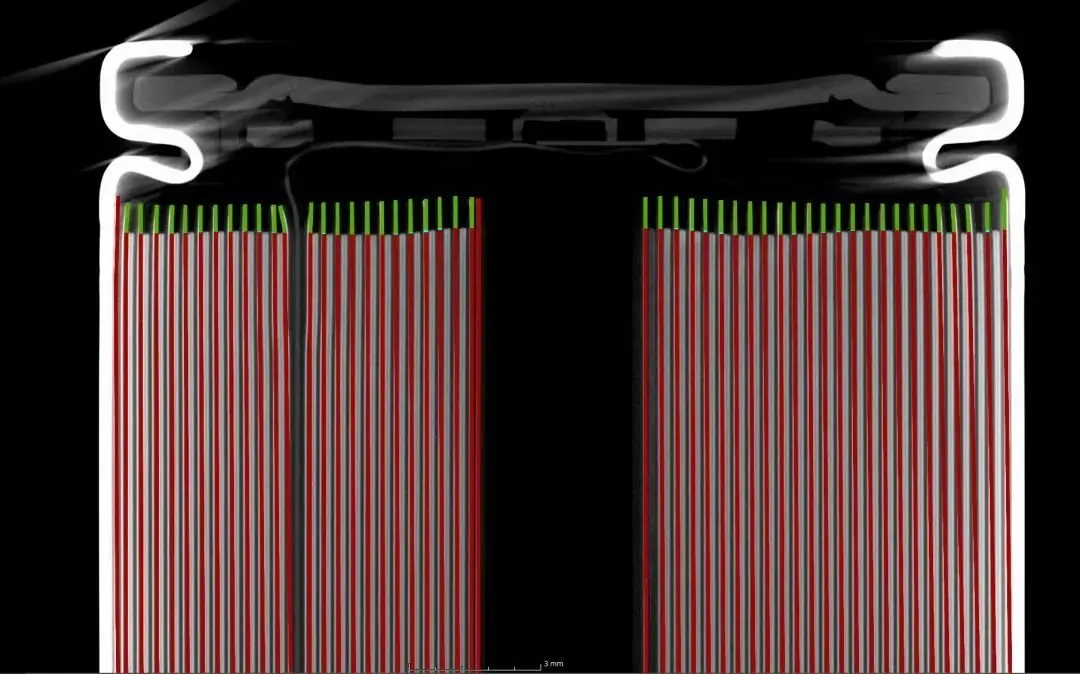 CT slice through a battery cell with the anode and cathode edges marked for overhang measurement