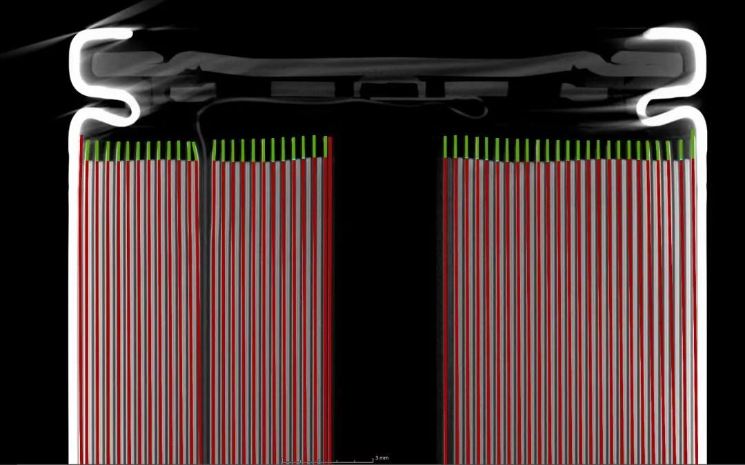 CT slice of a battery cell with anode and cathode layers marked for overhang measurement